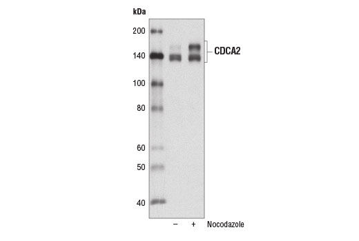 Western Blotting Image 2: CDCA2 (D7T4P) Rabbit mAb