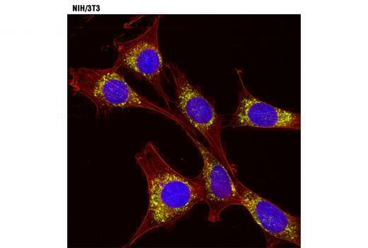 undefined Image 10: MHC Class I Antigen Processing and Presentation Antibody Sampler Kit