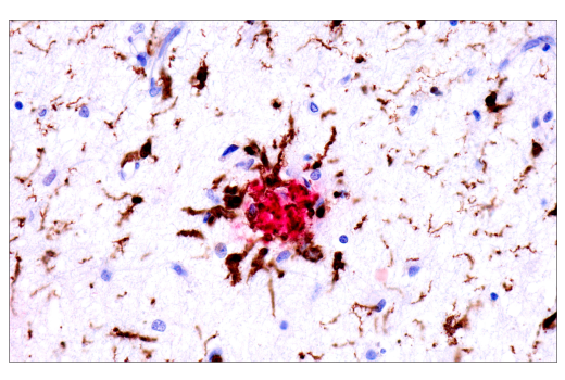 Immunohistochemistry Image 1: SignalStain<sup>®</sup> IHC Dual Staining Kit (HRP, Rabbit, Brown / AP, Mouse, Red)
