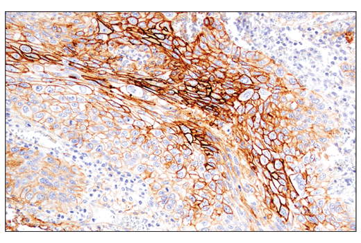 Immunohistochemistry Image 2: CD54/ICAM-1 (E3Q9N) XP<sup>®</sup> Rabbit mAb (BSA and Azide Free)