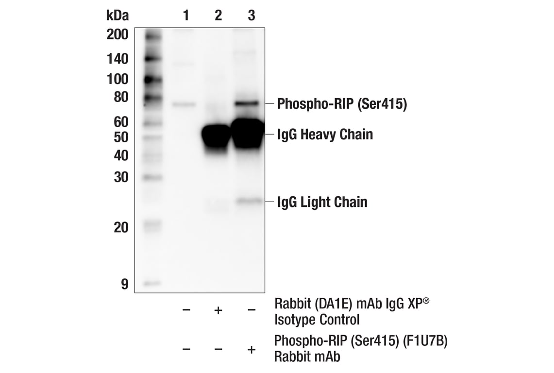 Immunoprecipitation Image 1: Phospho-RIP (Ser415) (F1U7B) Rabbit mAb