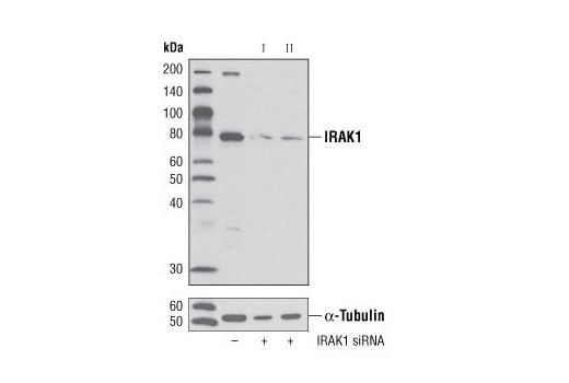 Western Blotting Image 4: IRAK1 (D51G7) Rabbit mAb