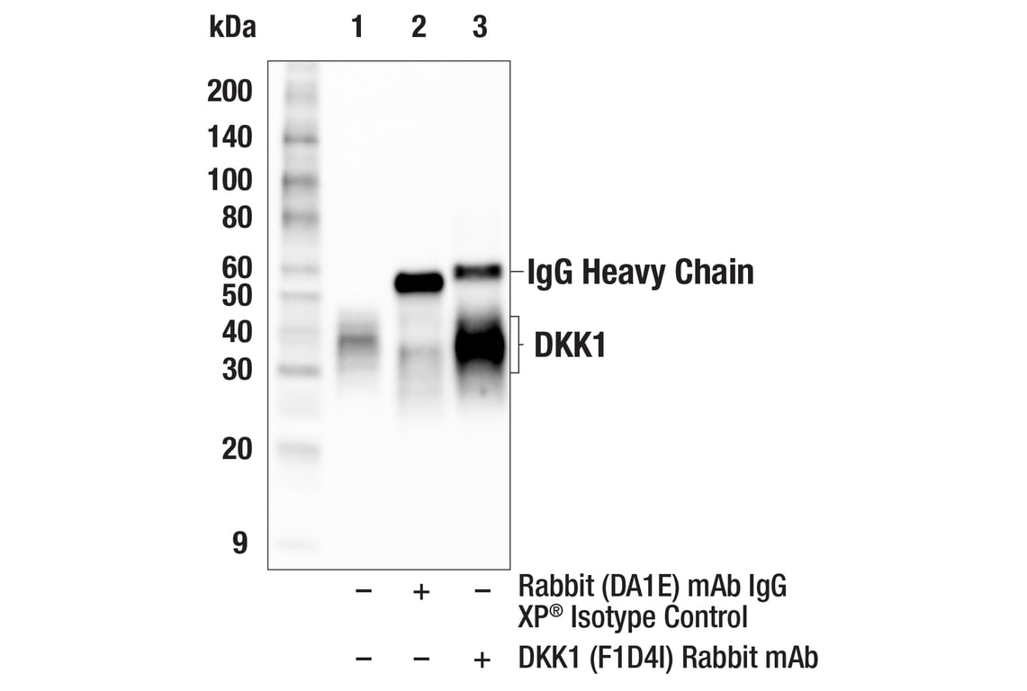 Immunoprecipitation Image 1: DKK1 (F1D4I) Rabbit mAb
