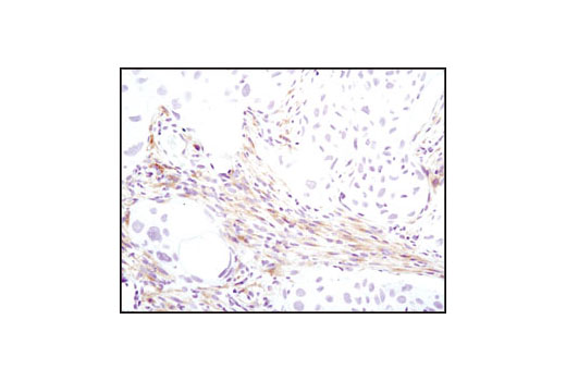 Immunohistochemistry Image 4: PDGF Receptor α (D1E1E) XP<sup>®</sup> Rabbit mAb (BSA and Azide Free)