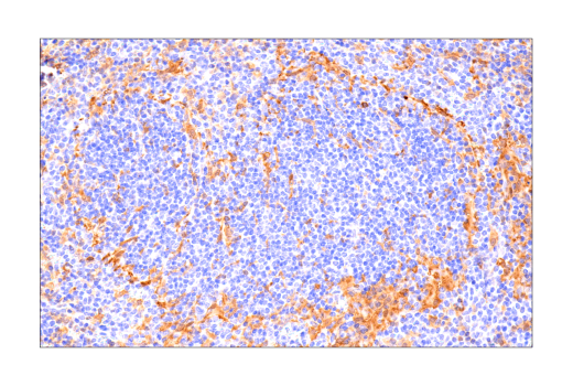 Immunohistochemistry Image 4: SLP-76 (E4N7E) Rabbit mAb