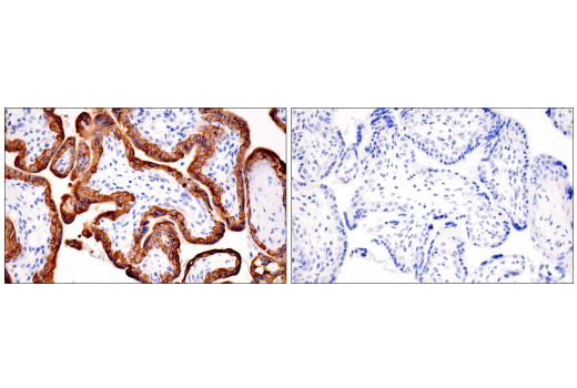 Immunohistochemistry Image 6: Pan-Keratin (5D3/LP34) Mouse mAb