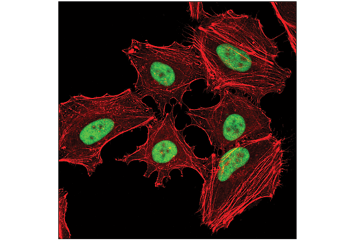 Immunofluorescence Image 1: YY1 (D5D9Z) Rabbit mAb
