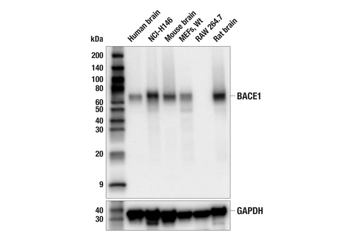 Western Blotting Image 1: BACE1 (F4Z7X) Rabbit mAb (BSA and Azide Free)