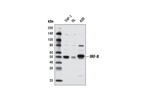 Western Blotting Image 2: IRF-8 (D20D8) Rabbit mAb