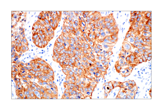 Immunohistochemistry Image 4: Pan-Keratin (AE1/AE3) Mouse mAb