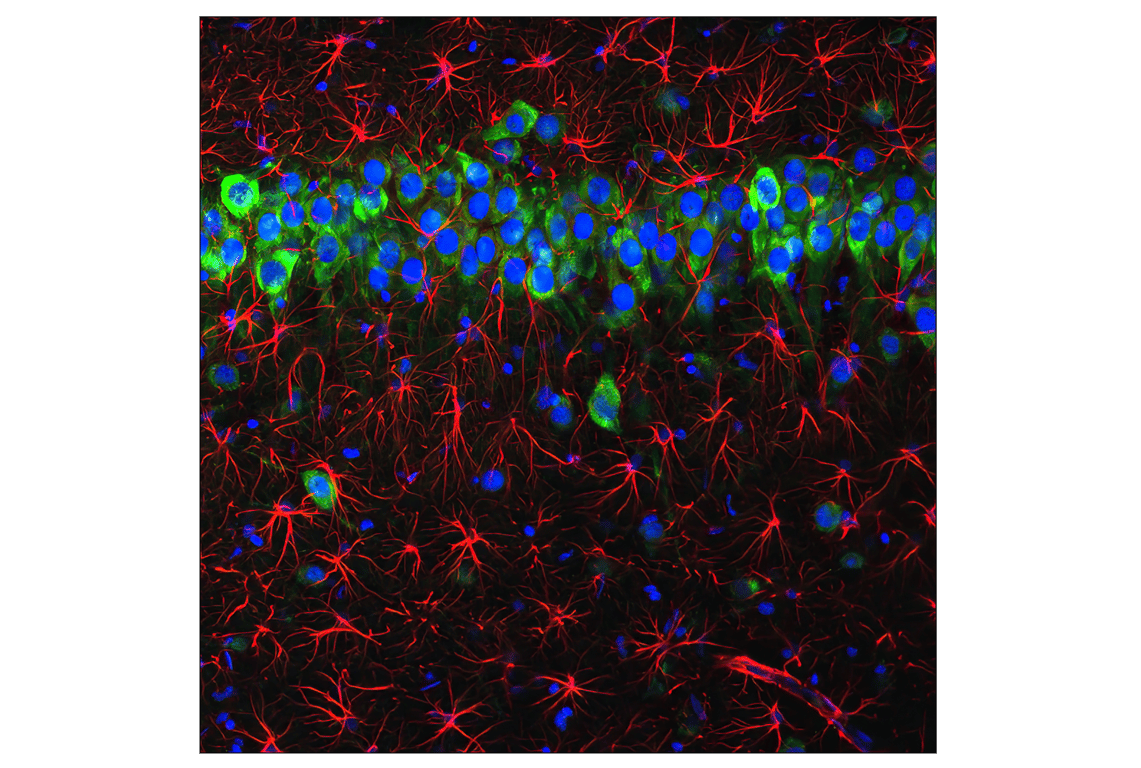 Immunofluorescence Image 1: GFAP (GA5) Mouse mAb (BSA and Azide Free)