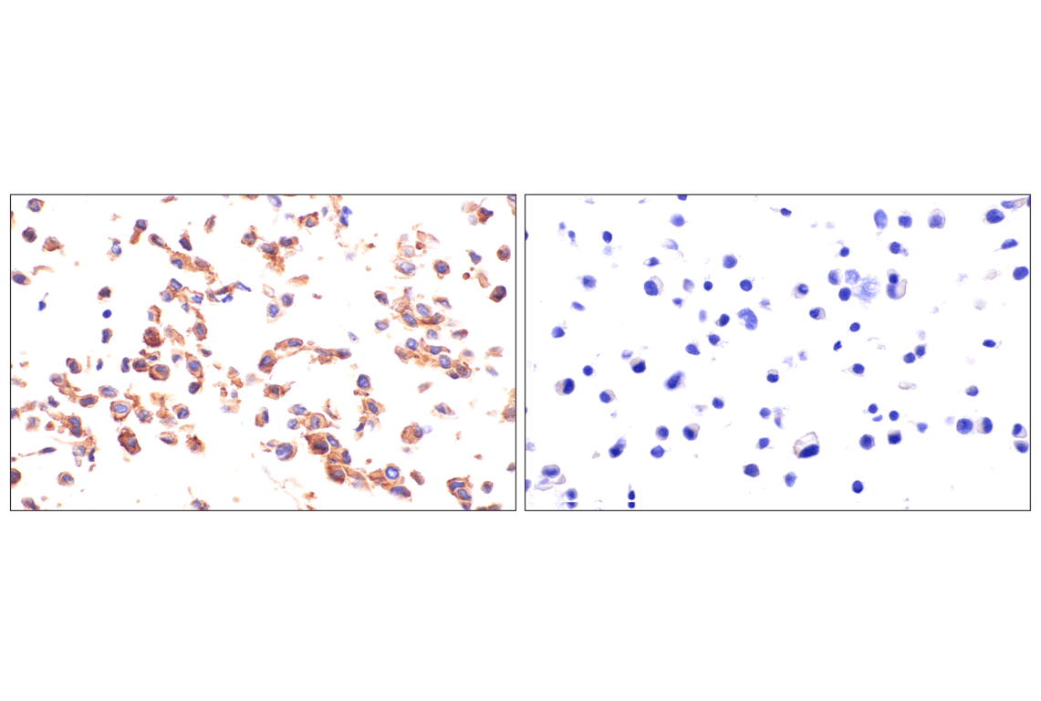 Immunohistochemistry Image 8: Axl (E3Z2H) Rabbit mAb (BSA and Azide Free)