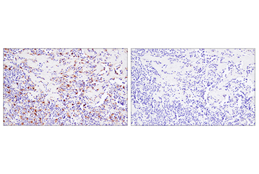 Immunohistochemistry Image 3: 4-1BB/CD137/TNFRSF9 (E6Z7F) XP<sup>®</sup> Rabbit mAb