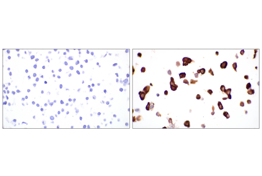 Immunohistochemistry Image 4: SARS-CoV-2 Nucleocapsid Protein (E8R1L) Mouse mAb