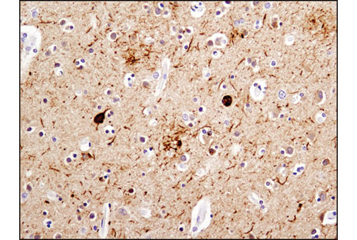 Immunohistochemistry Image 1: Phospho-Tau (Thr181) (D9F4G) Rabbit mAb (BSA and Azide Free)