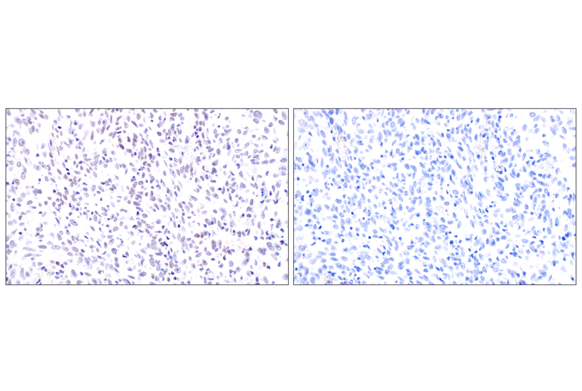 Immunohistochemistry Image 9: MDM2 (F7W7X) Rabbit mAb
