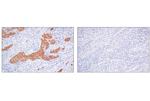 Immunohistochemistry Image 4: MAGE-A4 (E7O1U) XP<sup>®</sup> Rabbit mAb (BSA and Azide Free)