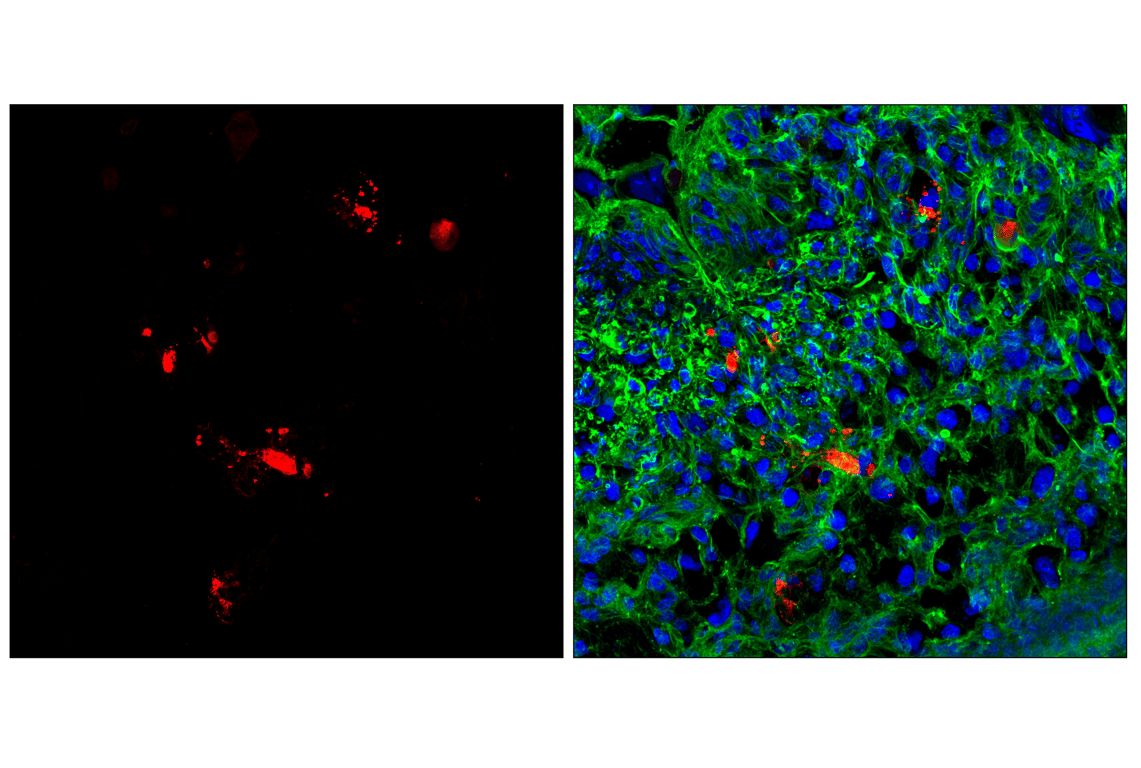 Immunofluorescence Image 1: Granzyme F (E2U7L) Rabbit mAb (Alexa Fluor<sup>®</sup> 647 Conjugate)