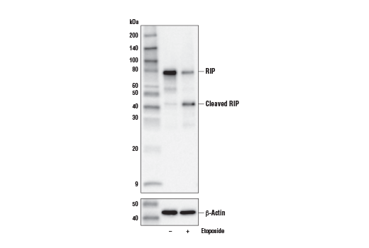 Western Blotting Image 3: RIP (E8S7U) XP<sup>®</sup> Rabbit mAb