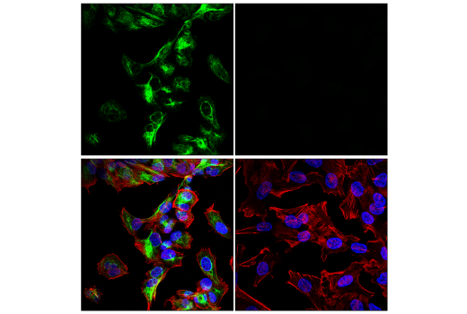 Immunofluorescence Image 1: Neurofilament-M (E7L2T) Rabbit mAb