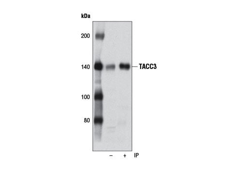 Immunoprecipitation Image 1: TACC3 (D9E4) XP<sup>®</sup> Rabbit mAb