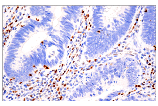 undefined Image 37: Human Exhausted CD8<sup>+</sup> T Cell IHC Antibody Sampler Kit