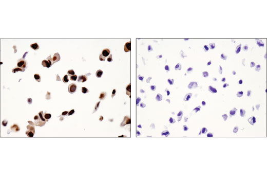 Immunohistochemistry Image 2: NKX3.1 (D6D2Z) XP<sup>®</sup> Rabbit mAb