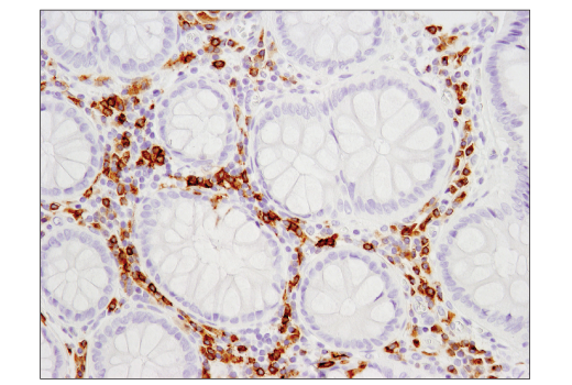 Immunohistochemistry Image 2: CD79B (D7V2F) Rabbit mAb (BSA and Azide Free)