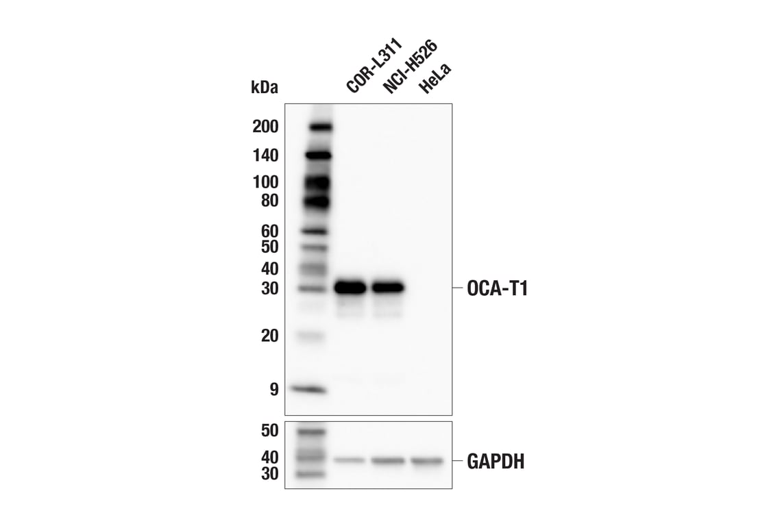 Western Blotting Image 1: OCA-T1 (E4A8S) Rabbit mAb