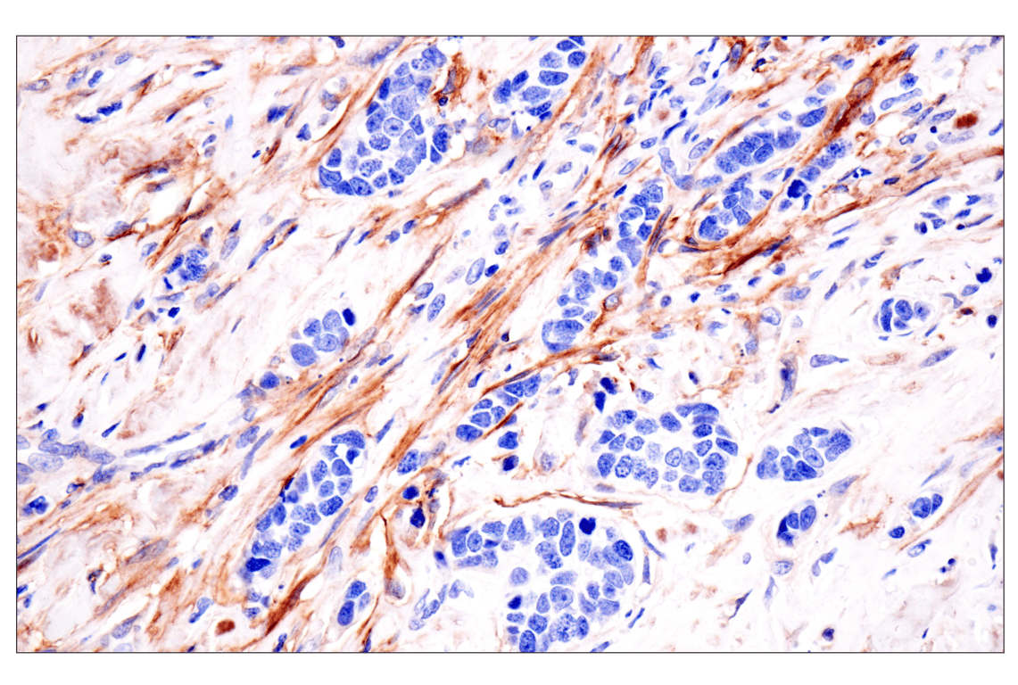 Immunohistochemistry Image 1: LRRC15 (E4X8J) Rabbit mAb