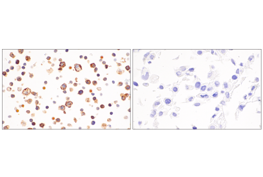 Immunohistochemistry Image 6: ICOS (E5F7E) Rabbit mAb (BSA and Azide Free)