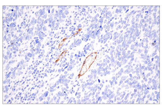 Immunohistochemistry Image 3: CD62P/P-Selectin (E8Q1W) XP<sup>®</sup> Rabbit mAb (BSA and Azide Free)