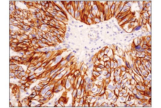 undefined Image 1: Catenin δ-1 (D7S2M) XP<sup>®</sup> Rabbit mAb