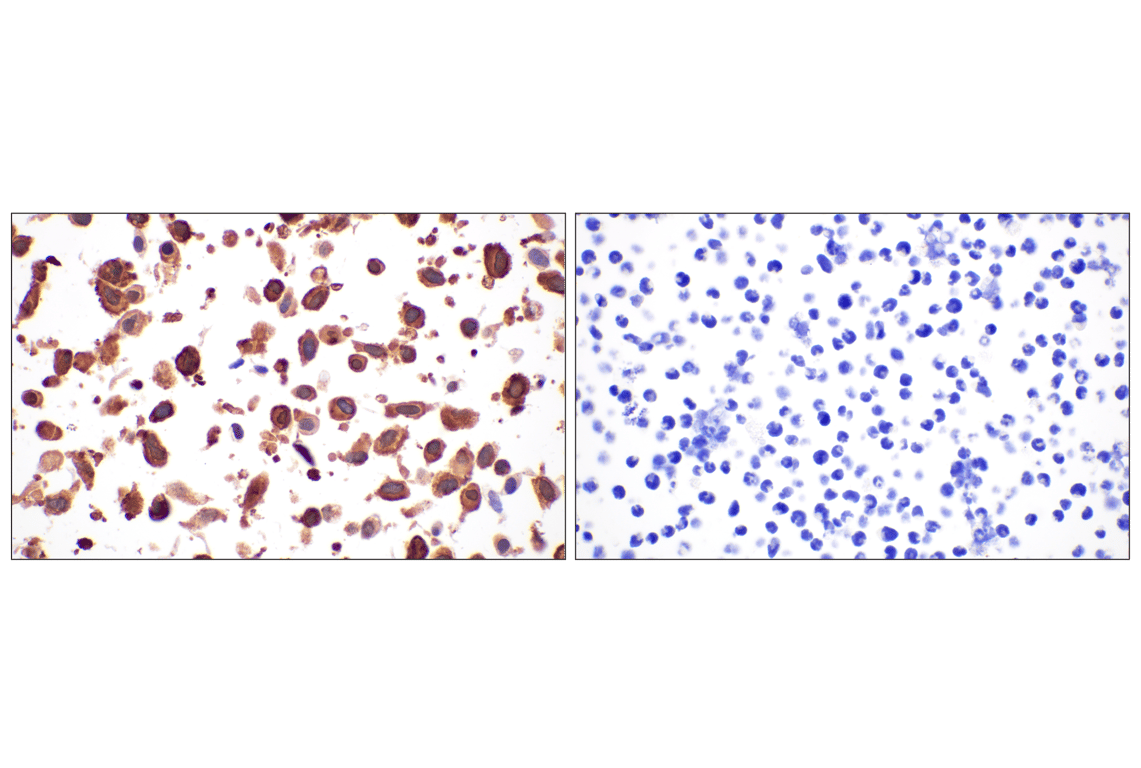 Immunohistochemistry Image 15: Annexin V (E3W8V) Rabbit mAb (BSA and Azide Free)