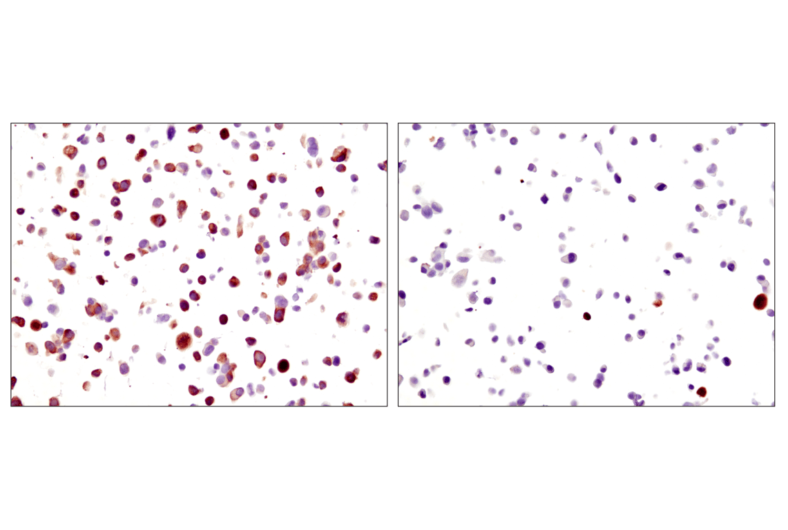 Immunohistochemistry Image 1: Phospho-S6 Ribosomal Protein (Ser235/236) (D57.2.2E) XP<sup>®</sup> Rabbit mAb (BSA and Azide Free)