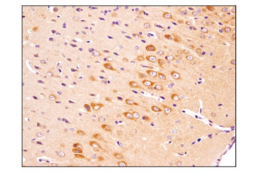 undefined Image 34: TREM2-dependent mTOR Metabolic Fitness Antibody Sampler Kit