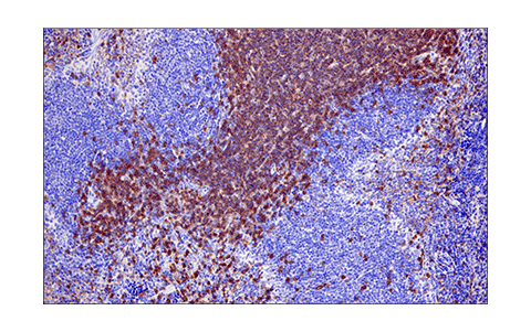 Immunohistochemistry Image 5: LAT (E3U6J) XP<sup>®</sup> Rabbit mAb (BSA and Azide Free)