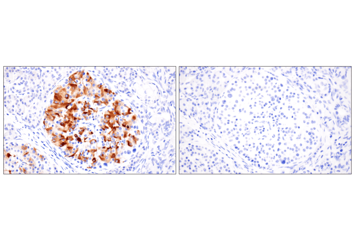 Immunohistochemistry Image 5: VGLUT2 (F1T6V) Rabbit mAb