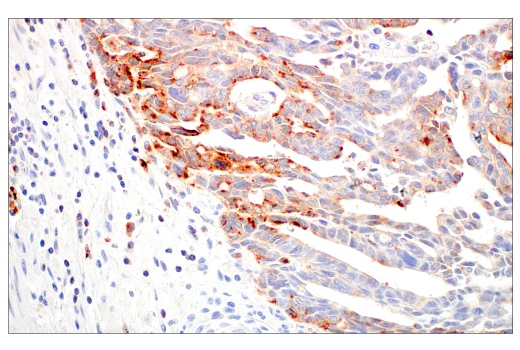 Immunohistochemistry Image 3: LAMP3/CD208 (E6E5U) XP<sup>®</sup> Rabbit mAb (BSA and Azide Free)