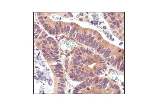 undefined Image 9: PhosphoPlus<sup>®</sup> IκBα (Ser32/Ser36) Antibody Duet