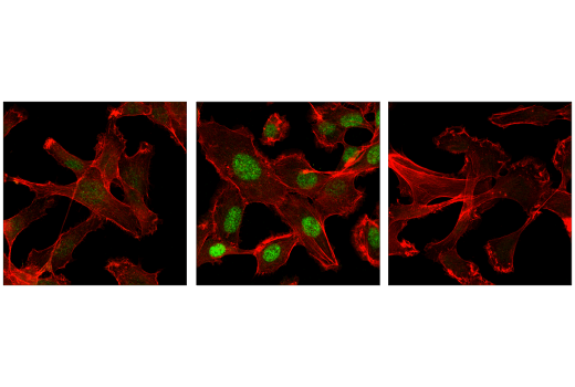undefined Image 6: PhosphoPlus<sup>®</sup> SMAD2 (Ser465/467) Antibody Duet