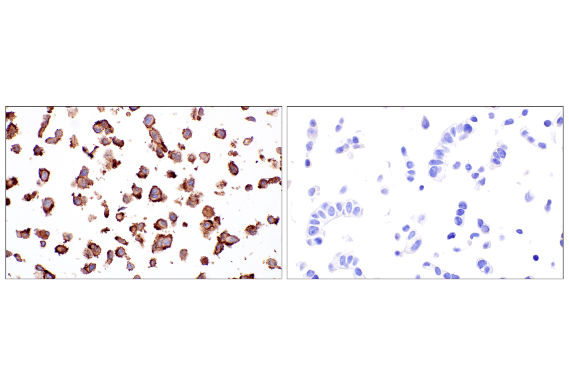 Immunohistochemistry Image 9: CD105/Endoglin (F9C5Q) Rabbit mAb