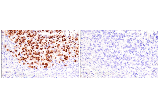 Immunohistochemistry Image 7: Olig2 (E6G6Q) XP<sup>®</sup> Rabbit mAb (BSA and Azide Free)