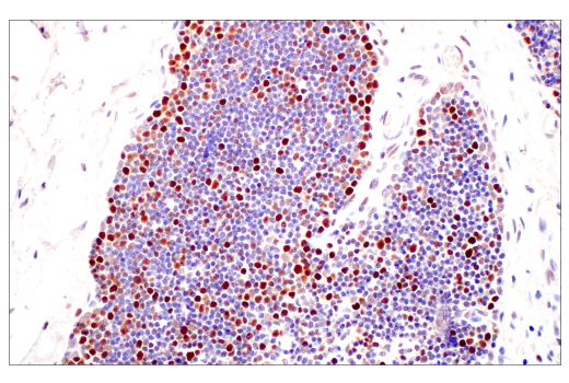 Immunohistochemistry Image 8: DNMT1 (D63A6) XP<sup>®</sup> Rabbit mAb (BSA and Azide Free)