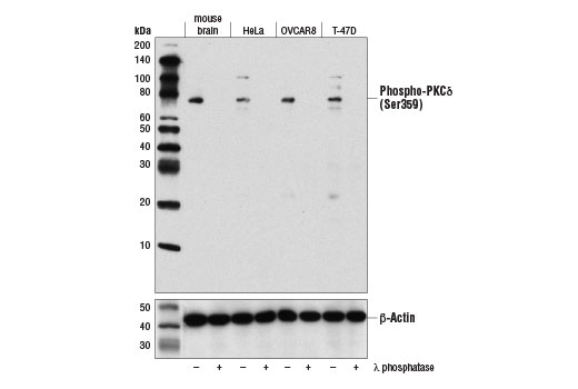 Western Blotting Image 1: Phospho-PKCδ (Ser359) (D2X1P) Rabbit mAb