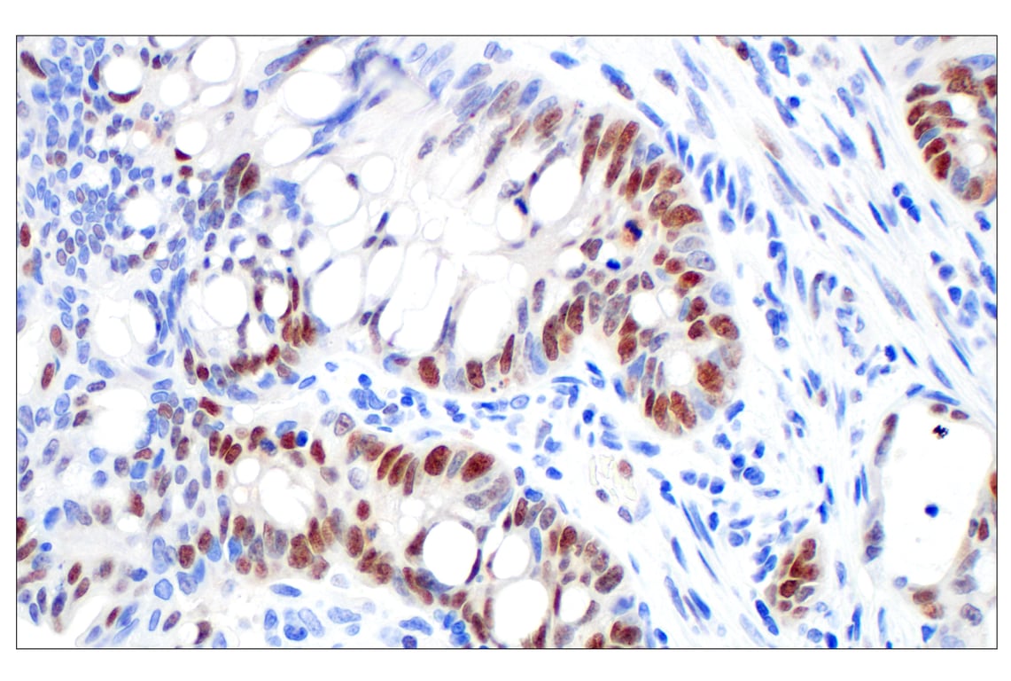 Immunohistochemistry Image 3: BRCA1 (E5S9G) Rabbit mAb