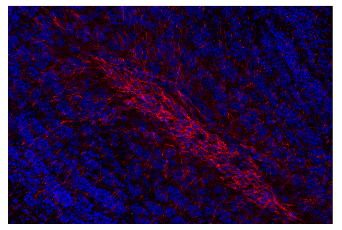Immunohistochemistry Image 2: Doublecortin (E3S7L) Rabbit mAb (Alexa Fluor<sup>®</sup> 555 Conjugate)