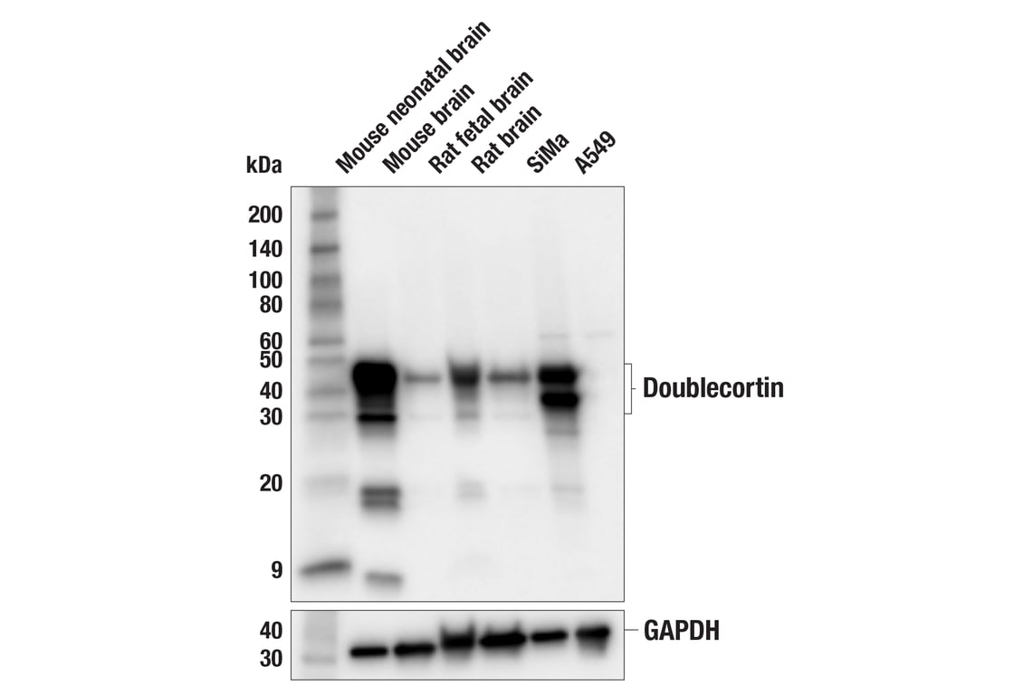 Western Blotting Image 1: Doublecortin (F6K9E) Rabbit mAb (BSA and Azide Free)