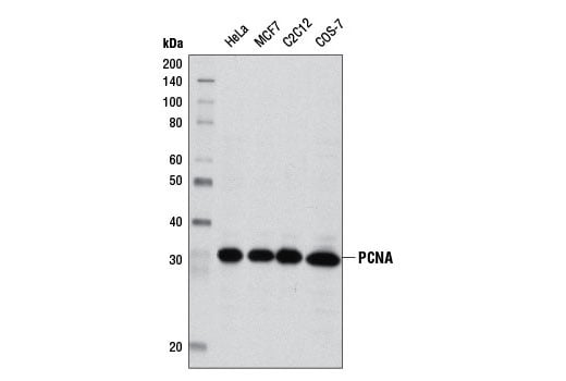 Western Blotting Image 1: PCNA (D3H8P) XP<sup>®</sup> Rabbit mAb 