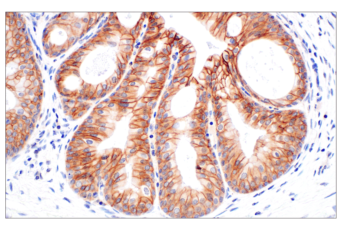 Immunohistochemistry Image 5: EpCAM (E6V8Y) XP<sup>®</sup> Rabbit mAb (BSA and Azide Free)